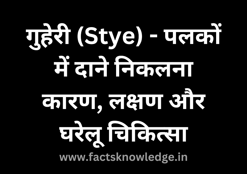 गुहेरी का इलाज | Guheri ka ilaj